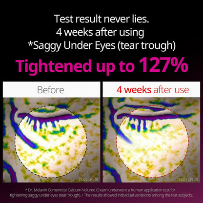 Dr.Melaxin CEMENRETE EYE CREAM