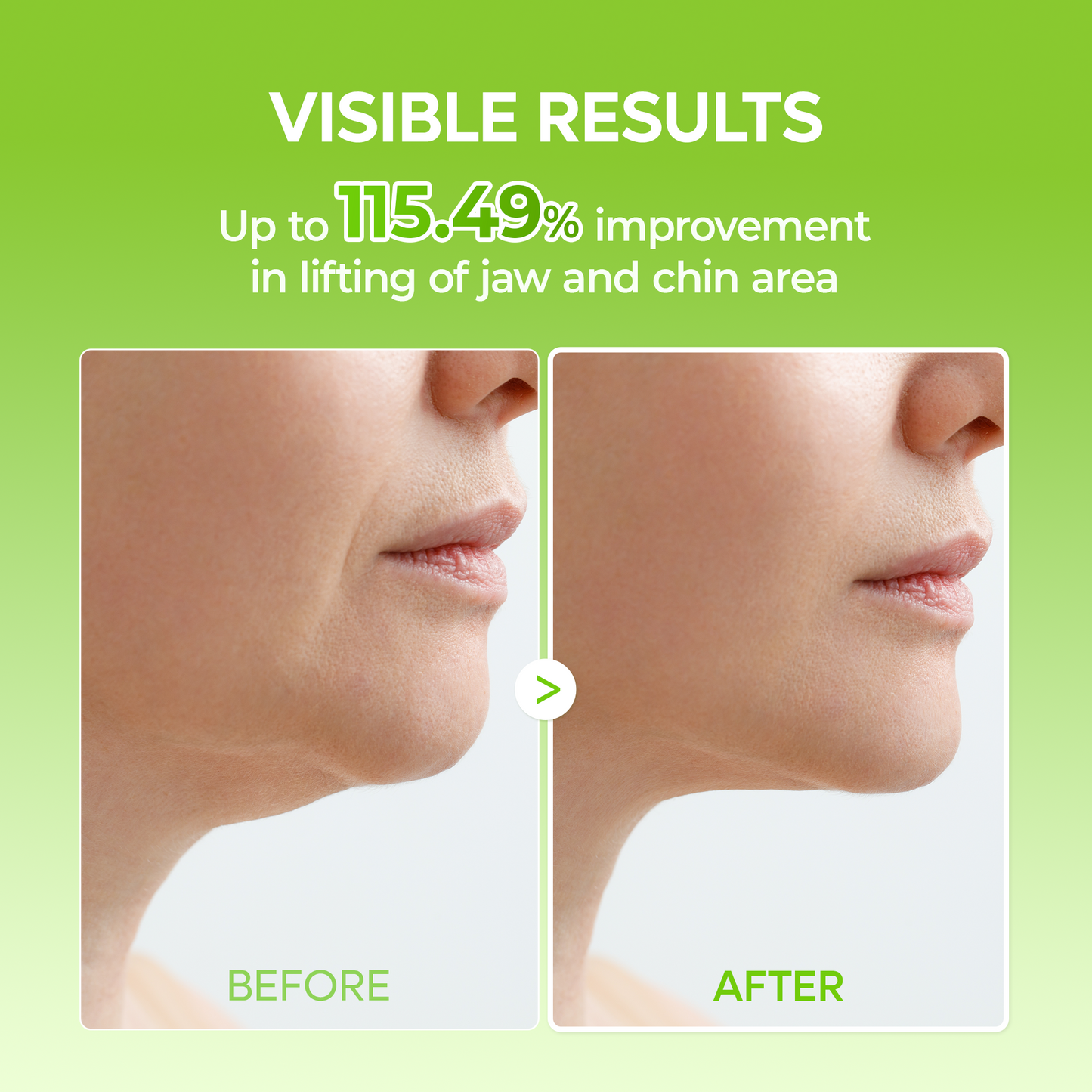Dr.Melaxin CACTOX V-Lifting Mewing Band – Cactox + Caffeine + Collagen Double Chin Lifting Band for Sagging Jawline & Facial Puffiness | 115.49% Jaw & Chin Lifting Improvement | Korean V-Line Lifting